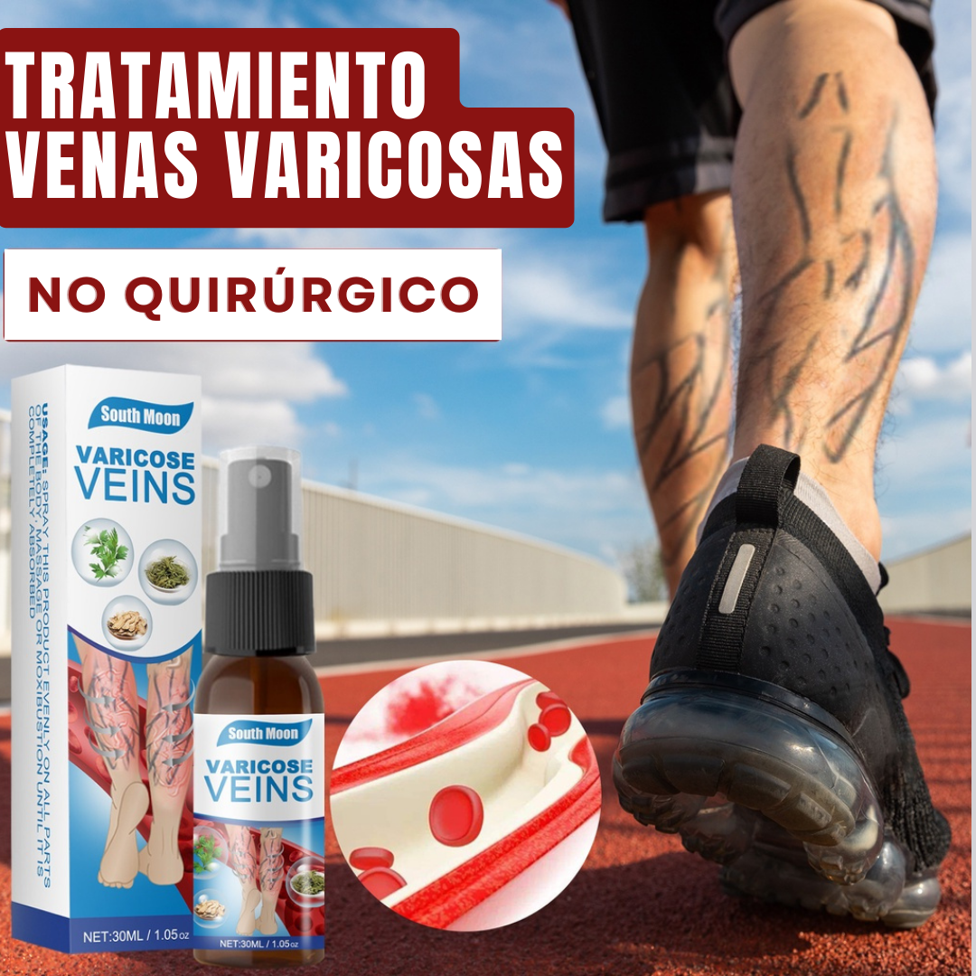Spray para Várices – Alivio, Mejora la Circulación y Embellece tus Piernas 💆‍♀️✨