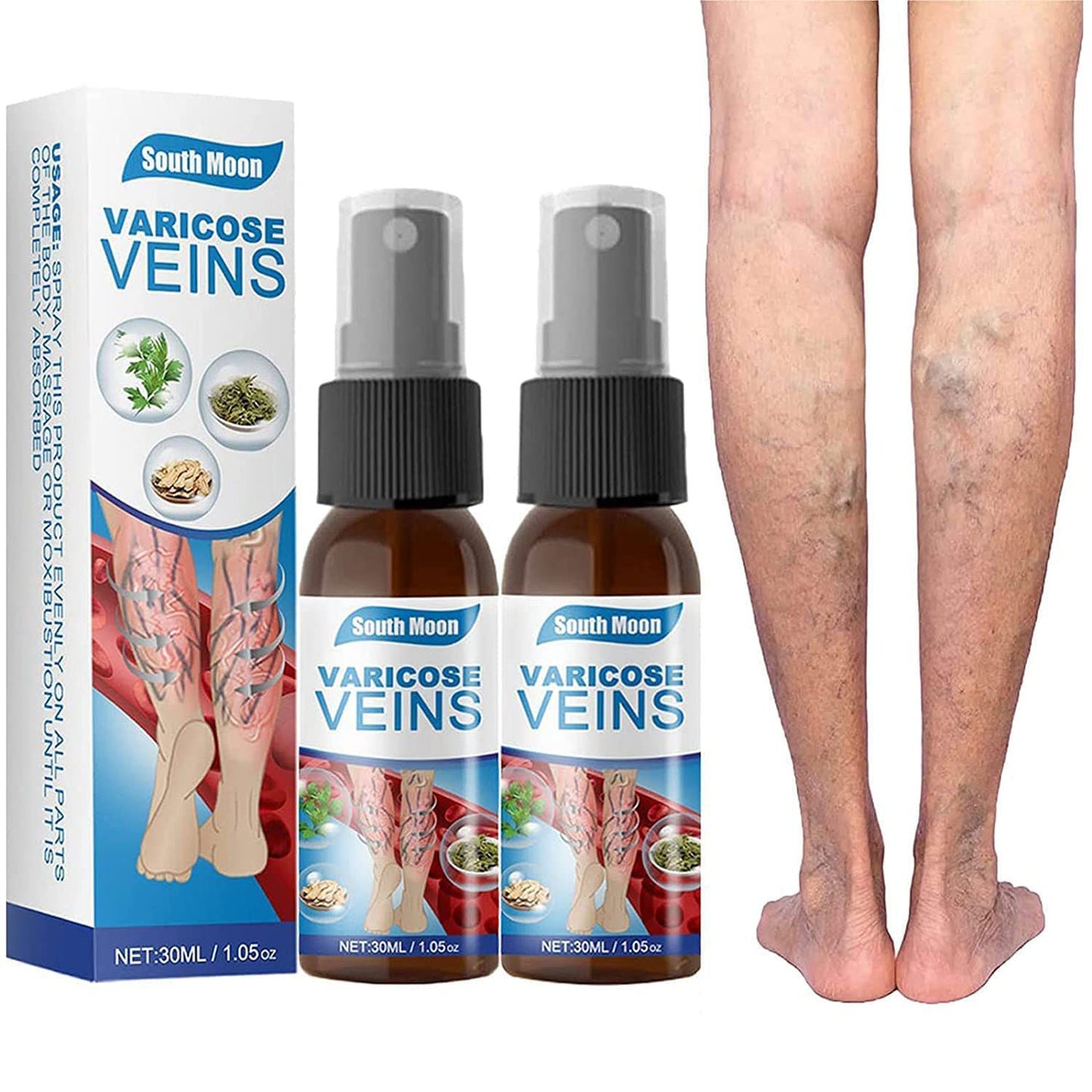 Spray para Várices – Alivio, Mejora la Circulación y Embellece tus Piernas 💆‍♀️✨