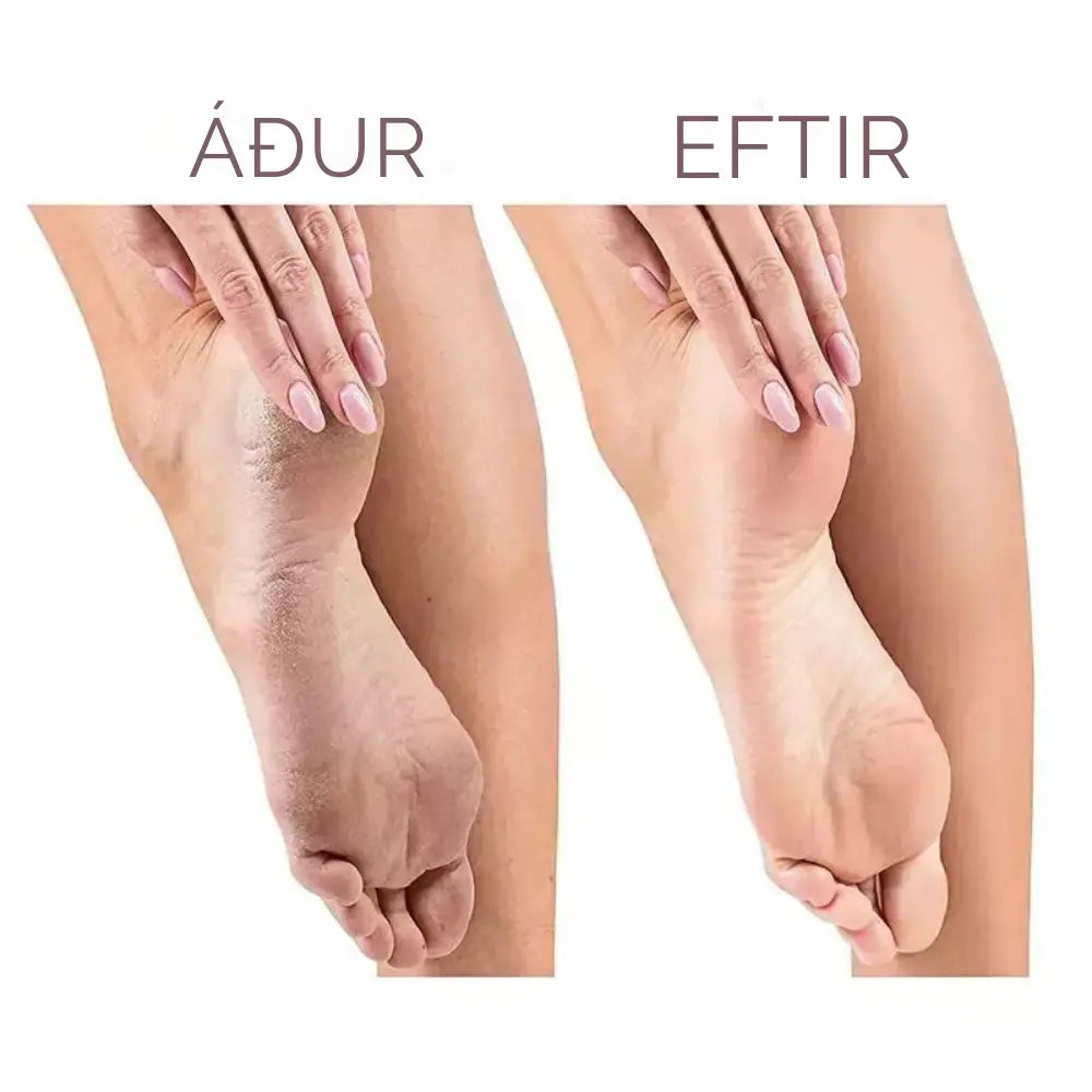 Removedor de Callos Recargable con Lija – Pedicura Profesional en Casa 🦶✨